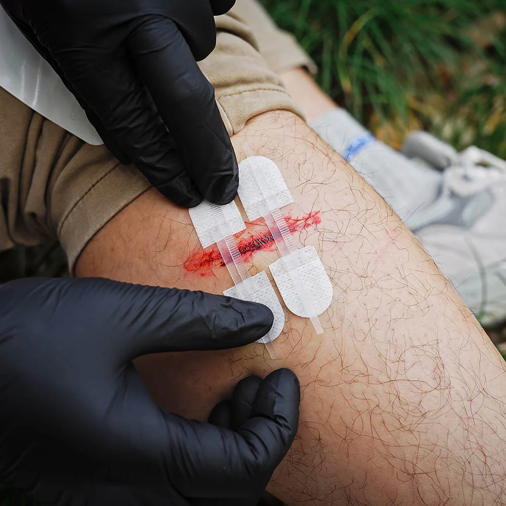 Wound Closure Kit——Rhino Rescue™ Laceration Kit Premium Wound Closure Kit Strips for Cuts and Scrapes - FDA CE Approved - Image 7