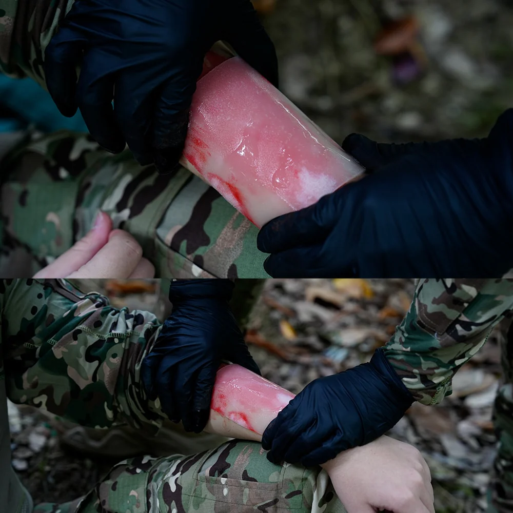 Burn Kit - Image 3